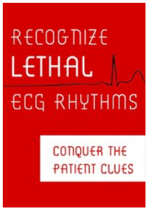 Robin Gilbert - Recognize Lethal ECG Rhythms - Conquer the Patient Clues